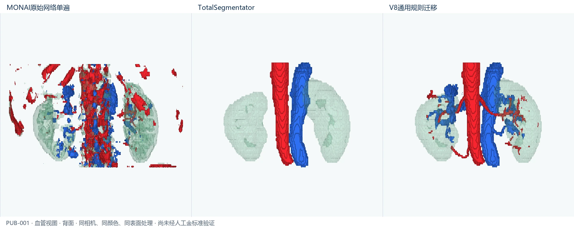 PUB-001 血管 back comparison